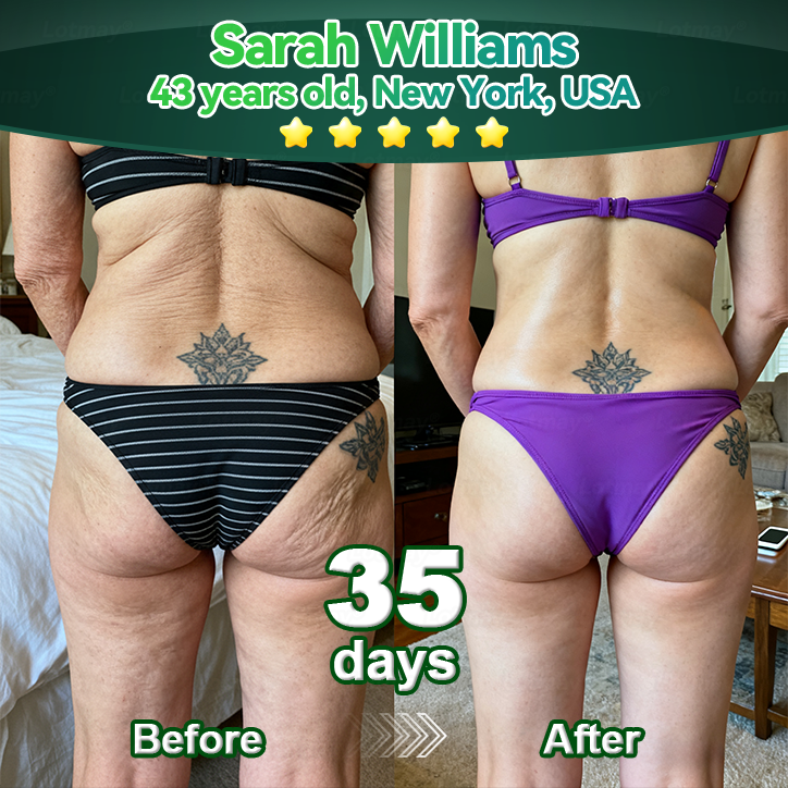 🎄🇬🇧 𝐂𝐡𝐫𝐢𝐬𝐭𝐦𝐚𝐬 𝐅𝐥𝐚𝐬𝐡 𝐒𝐚𝐥𝐞 – 𝟖𝟎% 𝐎𝐅𝐅 𝐓𝐨𝐝𝐚𝐲 𝐎𝐧𝐥𝐲! 🎁🌿 𝐃𝐄𝐄𝐕𝐎𝐎®  𝐒𝐭𝐞𝐦 𝐂𝐞𝐥𝐥 & 𝐂𝐨𝐥𝐥𝐚𝐠𝐞𝐧 𝐏𝐞𝐩𝐭𝐢𝐝𝐞 𝐎𝐫𝐚𝐥 𝐃𝐫𝐨𝐩𝐬 (𝐋𝐢𝐟𝐭 & 𝐅𝐢𝐫𝐦 𝐒𝐚𝐠𝐠𝐢𝐧𝐠 𝐒𝐤𝐢𝐧 & 𝐑𝐞𝐝𝐮𝐜𝐞 𝐖𝐫𝐢𝐧𝐤𝐥𝐞 𝐅𝐨𝐫𝐦𝐚𝐭𝐢𝐨𝐧)